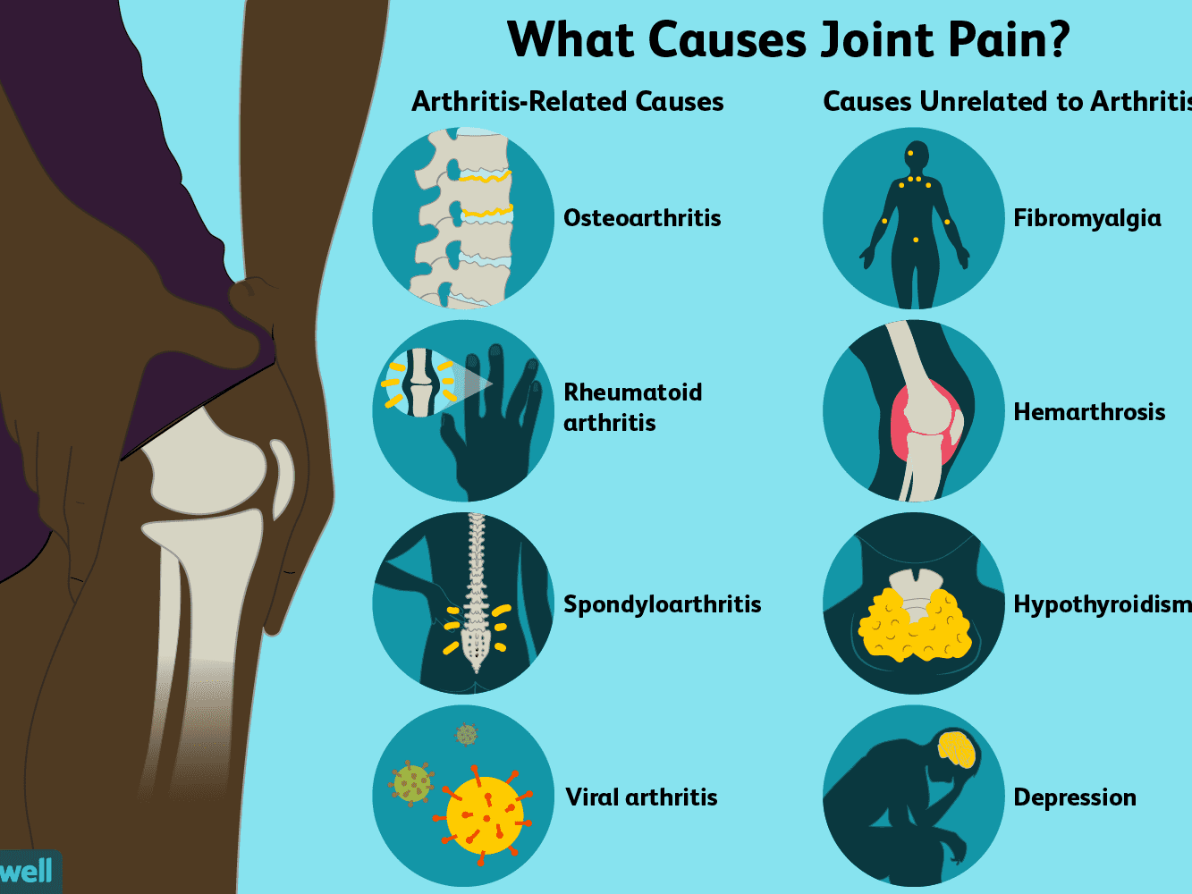 How to Treat Arthritis with Norland Products in Nigeria